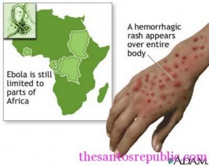 hemorrhaging rash from ebola virus